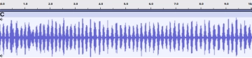 Sonogramme