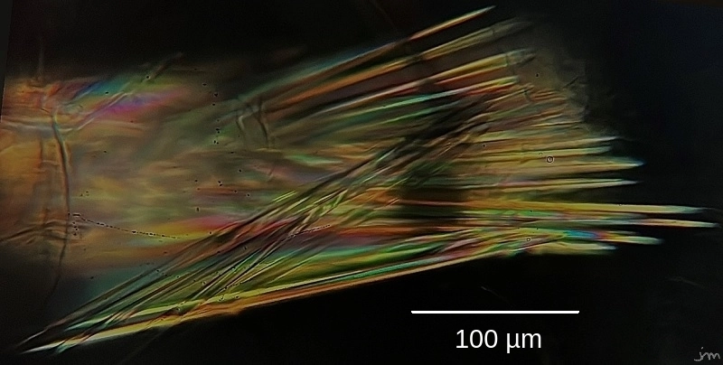 Faisceau de raphides d'oxalate de calcium Faisceau raphide oxalate calcium