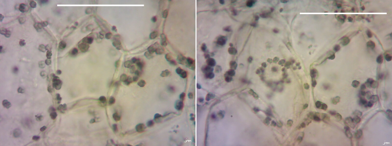 cuscute paremchyme réserves amidon