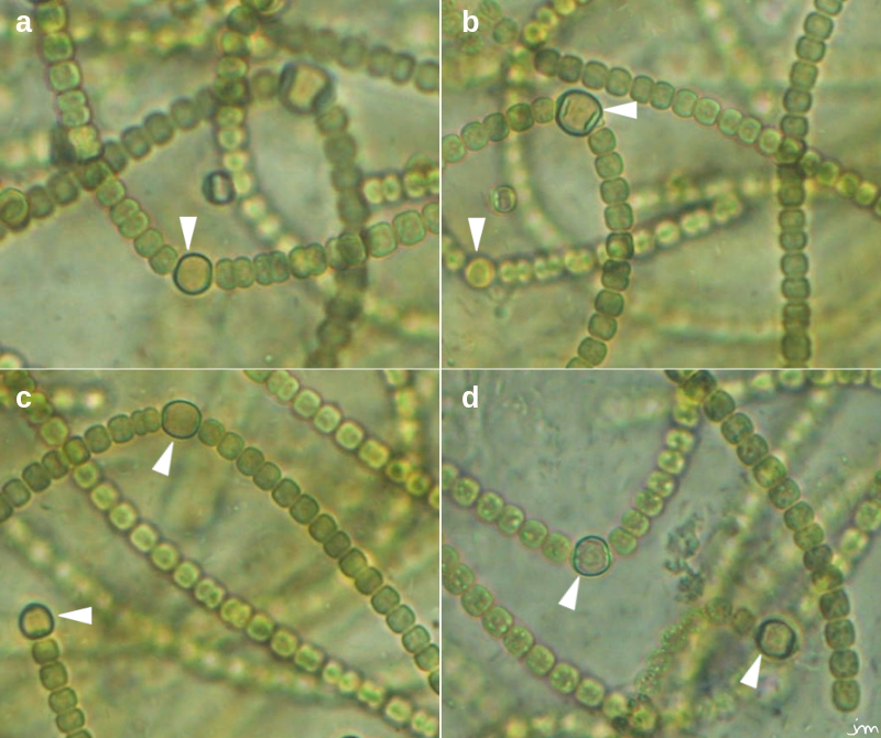 Nostoc colonie cyanobactérie microscope hétérocyste