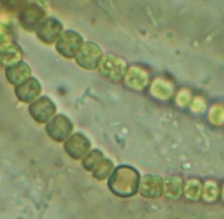 colonie Nostoc heterocyste